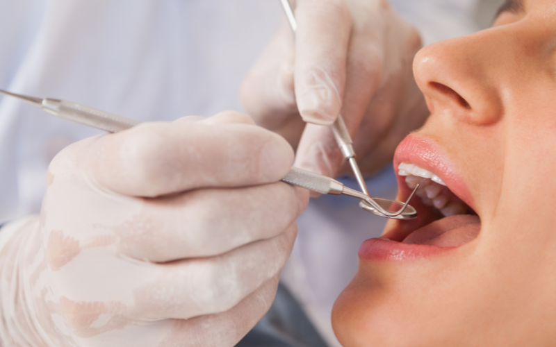 Tributação para Dentistas